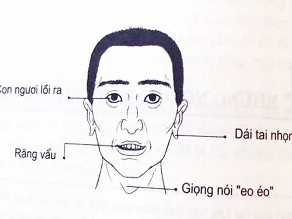 4 nét tướng đàn ông lắm điều nhiều chuyện, dễ gây thị phi khiến ai cũng không ưa