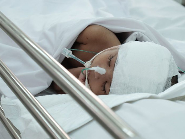 Bị ngã sưng ở gáy, bé trai 8 tuổi rơi vào hôn mê rồi qua đời: Cảnh giác với tình trạng chấn thương đầu của trẻ nhỏ