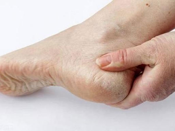 Gan có tốt hay không là do bàn chân 'biết trước', nếu bàn chân gửi 4 'tín hiệu' này, đừng bất cẩn