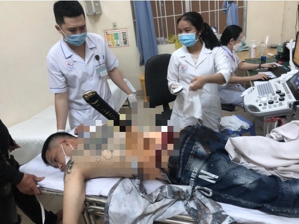 Nhờ người tình bẫy 'đối thủ' đến rồi dùng kiếm Nhật đâm