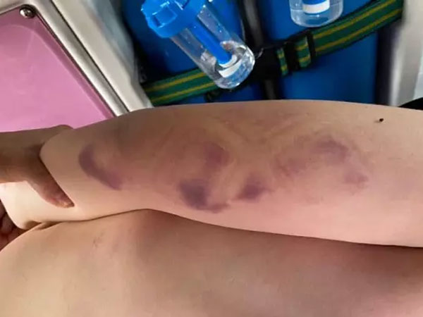 Giám định hiện trường vụ bé trai người Nhật đuối nước ở Mũi Né