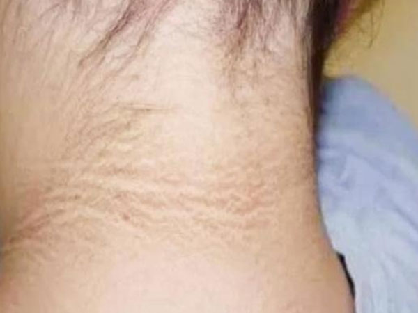 Ung thư trong cơ thể, tiên tri cổ? Xin nhắc lại: Có 3 dấu hiệu bất thường ở cổ, có thể là ung thư đang đến gần