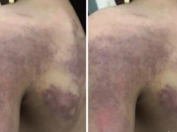 Cô giáo đánh học sinh do không làm được bài: Giám đốc Sở nói gì?