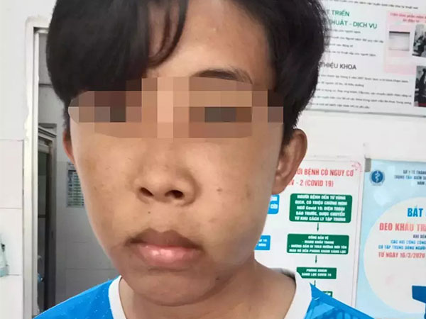 Nam sinh lớp 9 bị bảo vệ trường đánh gãy xương hàm