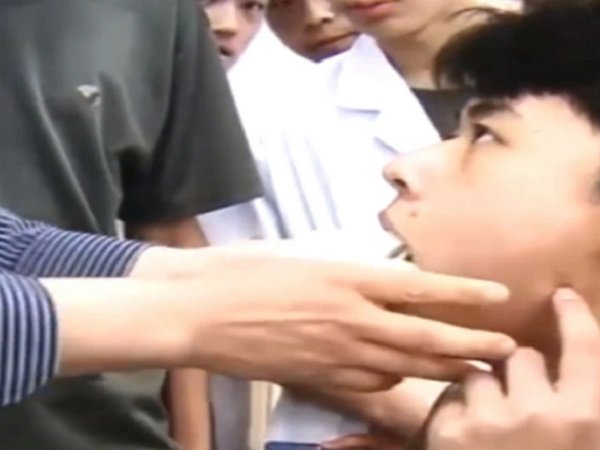 Ngáp ngủ 'sái quai hàm' trong lớp học, nam sinh được giảng viên 'cấp cứu' ngay sau đó