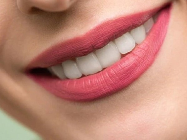 Những sai lầm phổ biến trong mùa hè có thể làm hỏng răng của bạn