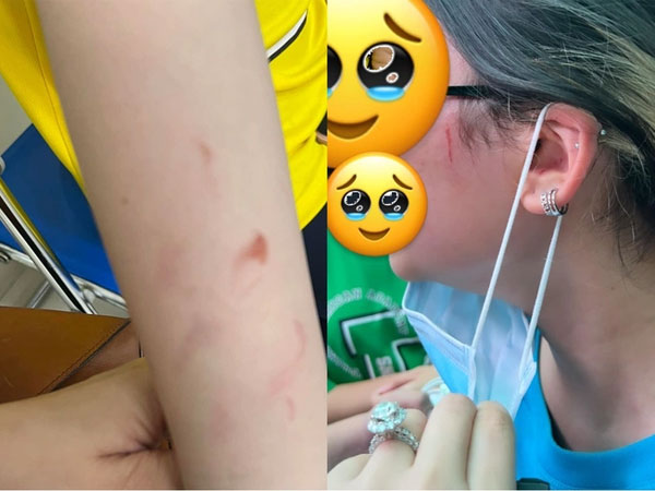 Đại học Quốc tế ở TP.HCM bị 'vạ lây' phải nhận 'bão' 1 sao sau vụ phụ huynh tố con bị bạn học hành hung