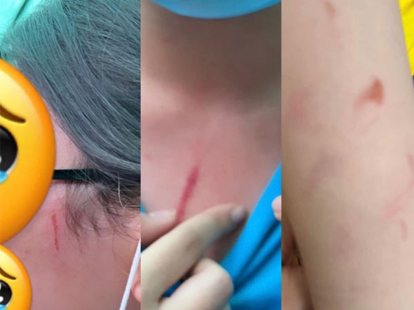 Vụ phụ huynh tố con bị đánh ở trường quốc tế: Nhà trường phát thông báo lúc... nửa đêm