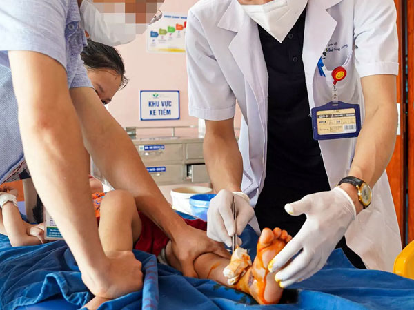 Bé 2 tuổi ở Hà Nội bị nát bàn chân, vỡ xương do cửa tự động