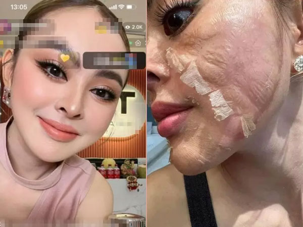 Ám ảnh gương mặt như 'mãng xà lột da' của Trang Nemo