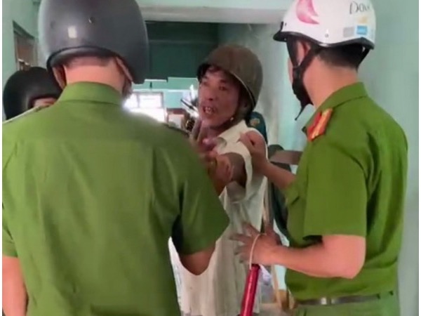Chồng chém vợ đang ly thân chỉ vì… không nghe điện thoại