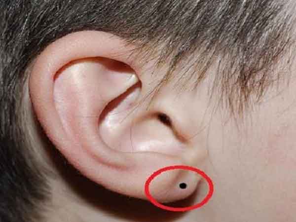 4 nốt ruồi trên khuôn mặt đàn ông là quý tướng, tài lộc ngày càng thịnh vượng, cuộc sống sung túc đủ đầy