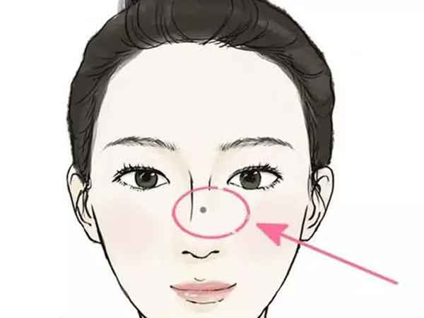 Những nốt ruồi phá tướng mặt phụ nữ, cả đời tiền chẳng có mà tình long đong