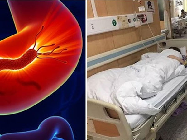 Đau bụng đi viện, cô gái 24 tuổi sốc nặng khi biết mình mắc K dạ dày: Triệu chứng dễ nhầm lẫn với rối loạn tiêu hóa nên ít người để tâm