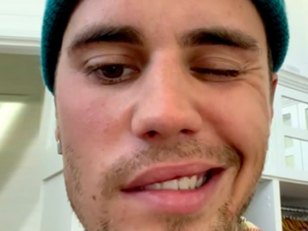 Loại bệnh hiếm khiến Justin Bieber bị liệt nửa mặt nguy hiểm ra sao?