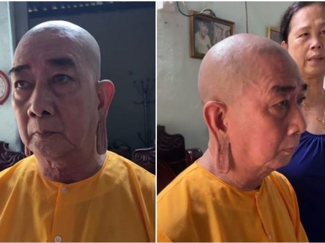 Chuyện lạ có thật: Ông chú xe ôm sở hữu đôi tai như tai Phật, tiết lộ cuộc sống tu tại gia suốt 20 năm