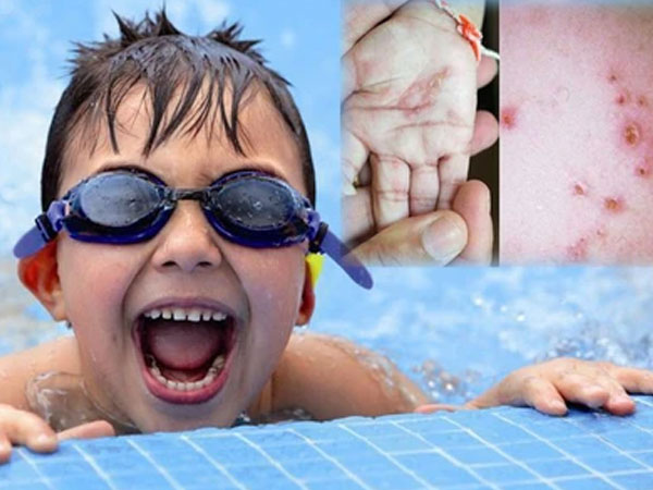 Đi bơi ngày hè nắng nóng: Nguy cơ mắc 8 bệnh nguy hiểm