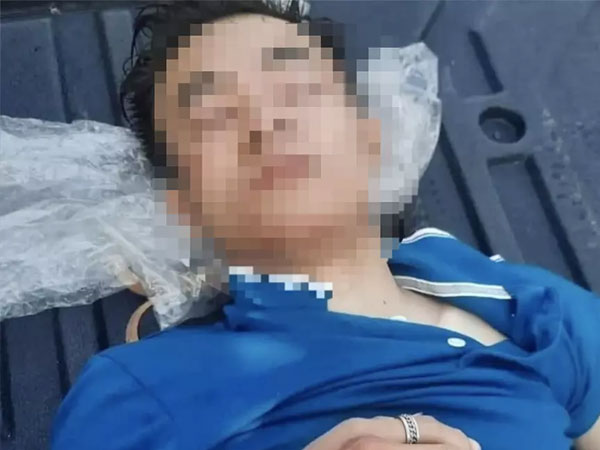 Xác định được nghi phạm đánh nam thanh niên 2003 dập não rồi vứt ngoài nghĩa trang