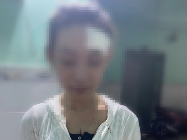 Công an điều tra vụ nữ công nhân bị đánh hội đồng Bình Dương
