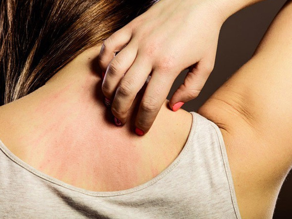 Những dấu hiệu cảnh báo cơ thể bạn đang chứa đầy độc tố, giải độc ngay trước khi quá muộn