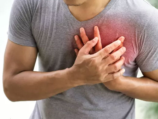 Năm triệu chứng có thể xuất hiện vài tháng trước cơn đau tim