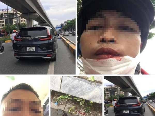 Tài xế xe ôm bị người đàn ông đi ô tô đánh gãy răng vì 'xin vượt mà không cho'