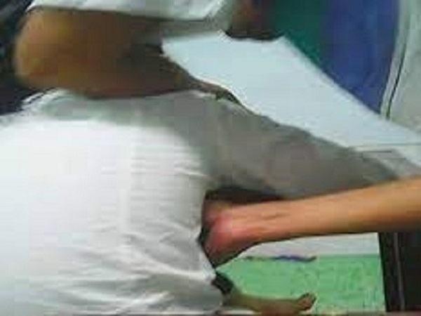 Nữ sinh lớp 9 nhiều lần dùng dao tự cắt vào tay, vào đùi vì bị thầy giáo chủ nhiệm sàm sỡ vùng nhạy cảm ngay trên lớp