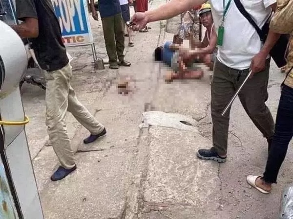 Điều chờ đợi kẻ thủ ác chém lìa chân nạn nhân ở Hà Nội