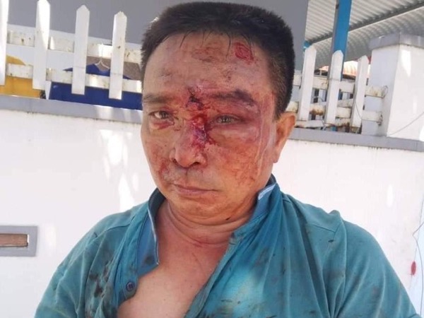 Mâu thuẫn gửi hàng, tài xế và phụ xe khách đánh người đàn ông dã man