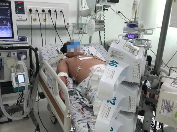 Cảnh báo nhiều trẻ thừa cân nguy kịch vì mắc sốt xuất huyết