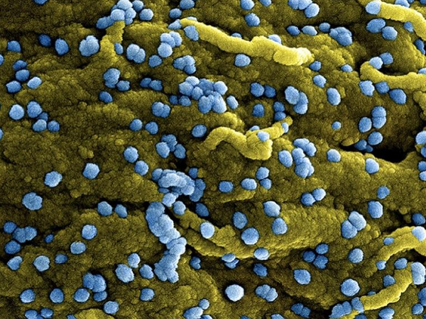 WHO báo động về đợt bùng phát mới của virus chết người