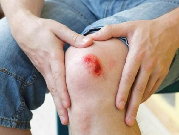 5 con giáp nửa cuối năm đề phòng tai nạn, rắn rết cắn, đề phòng xe cộ, đề phòng mất trộm