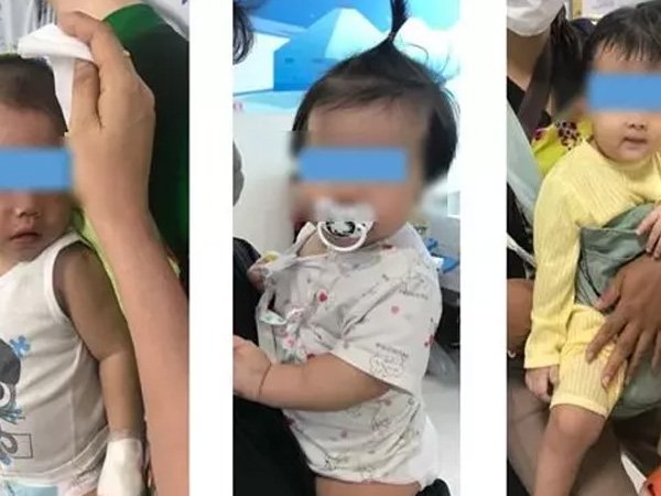 Cảnh báo nhiều trẻ nguy kịch, tử vong vì nhầm sốt xuất huyết với bệnh khác