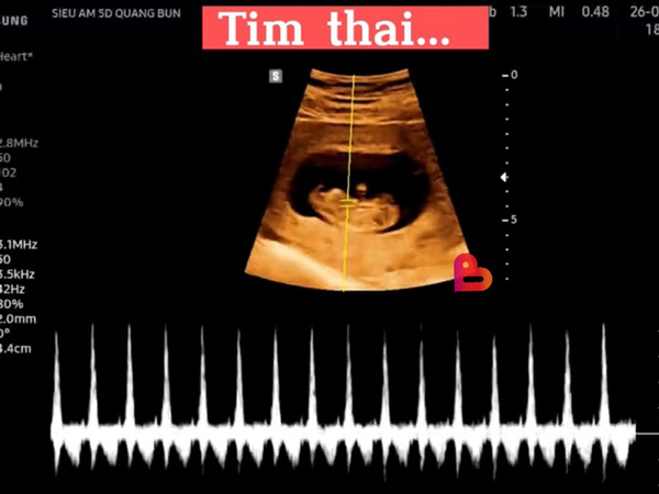 Bác sĩ phụ sản kể chuyện thai phụ 2 lần bỏ con khiến lòng người nhức nhối: Xin đừng từ chối một món quà!