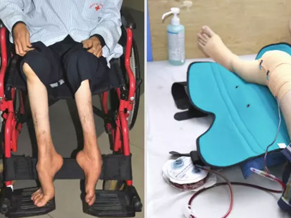 Căn bệnh khiến người mắc được bảo hiểm chi trả hàng chục tỷ đồng