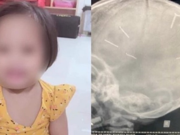 Những vụ bạo hành trẻ em gây rúng động