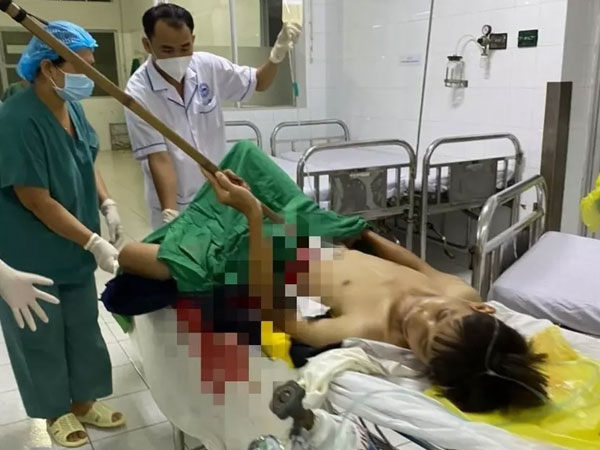 Đi cạo mủ cao su, nam thanh niên không may bị dao đâm thủng ruột