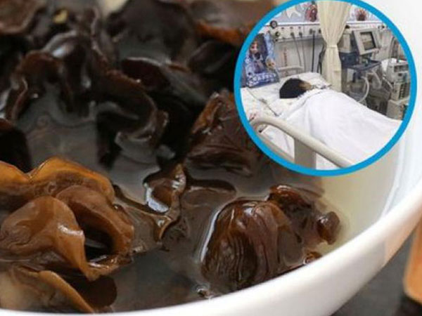 Hai vợ chồng cùng ăn một món, chỉ cứu được người chồng: Loại thực phẩm quen thuộc cực tốt nhưng cũng cực độc, biết mà dùng kẻo 'ân hận mấy cũng muộn'