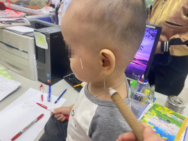 Bé trai 1 tuổi liệt mặt, méo miệng sau một đêm ngủ: Bác sĩ cảnh báo cha mẹ tuyệt đối không dùng quạt kiểu này cho con