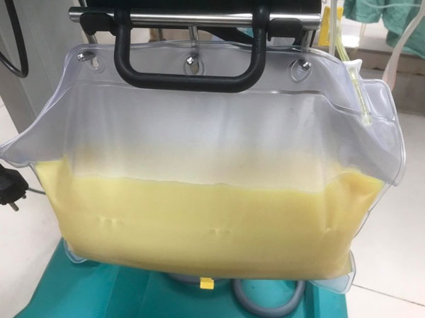 Cảnh báo căn bệnh khiến người đàn ông có huyết tương đục như sữa