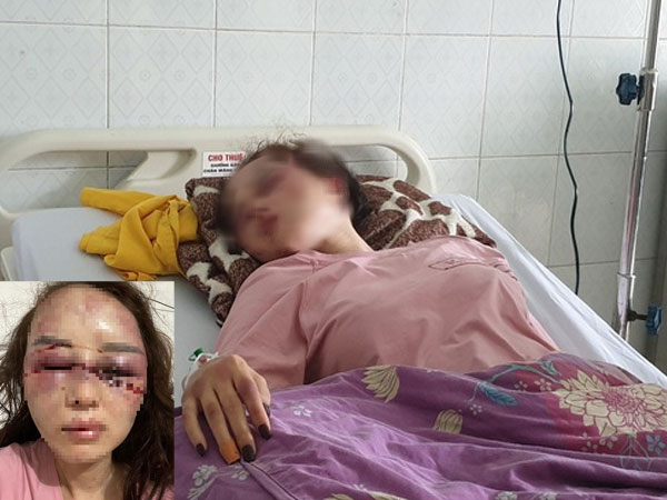 Công an vào cuộc vụ cán bộ QLTT đánh bạn gái dã man vì hát song ca với người khác