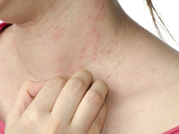 4 thay đổi trên da cảnh báo ung thư sớm, phát hiện dù chỉ 1 dấu hiệu cũng nên đi khám ngay