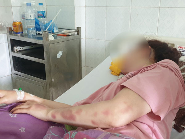 Cán bộ QLTT đánh bạn gái dã man vì hát song ca với người khác: Đã có gia đình, đánh bạn gái do quá yêu