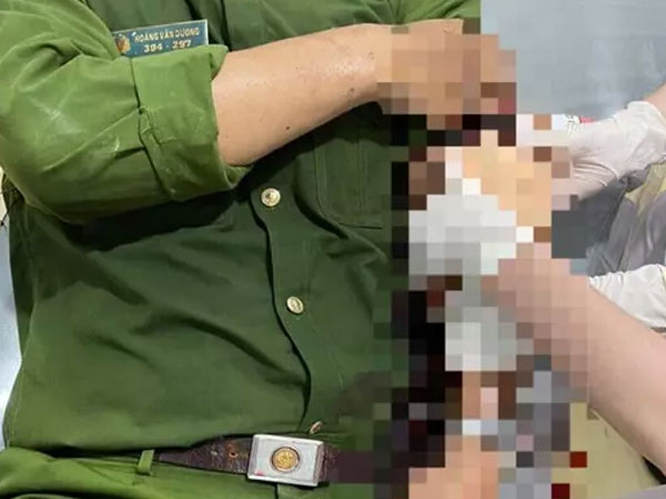 Án phạt nào cho kẻ 'cả gan' dùng xiên sắt đâm chiến sỹ công an làm nhiệm vụ?
