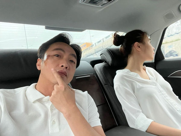 Cường Đô La trầy trụa gương mặt vì tai nạn giao thông, Đàm Thu Trang xót chồng nên ra lệnh cấm