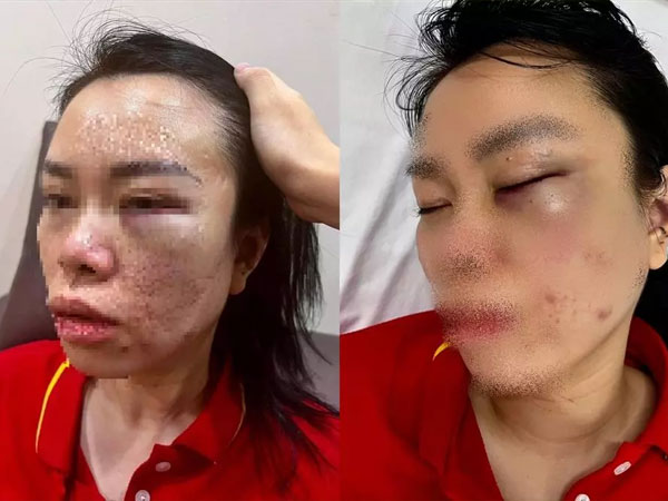 Người phụ nữ bị chồng cũ bắt giữ, đánh đập dã man suốt 1 ngày