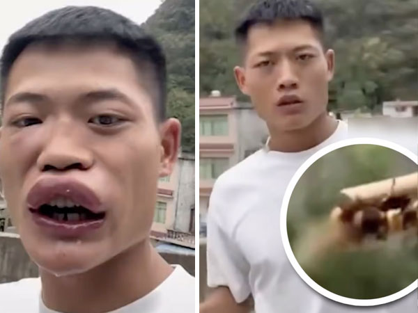 Ăn sống ong bắp cày để gây sự chú ý, nam influencer nhận về kết đắng cùng làn sóng phẫn nộ từ dư luận