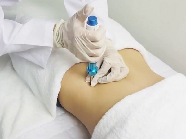 Nữ sinh Hà Nội đau đớn, hoảng loạn vì gặp họa sau khi giấu bố mẹ đi tiêm tan mỡ ở spa