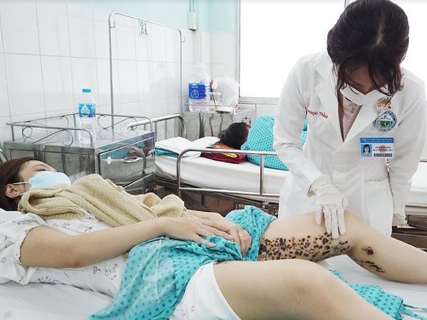 Cô gái 24 tuổi bị nhiễm trùng nặng, đi lại khó khăn sau khi chi 8 triệu đồng trị rạn da tại spa