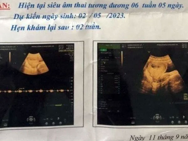 Bảo vệ trường mầm non 70 tuổi nghi xâm hại nữ sinh lớp 6 đến có thai